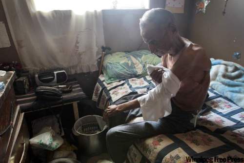 JOE.BRYKSA@FREEPRESS.MB.CA
Zach Harper shows his scars from operations related to tuberculosis. It’s hard for the elder to look after himself without running water.