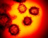 This undated electron microscope image made available by the U.S. National Institutes of Health in February 2020 shows the Novel Coronavirus SARS-CoV-2. Also known as 2019-nCoV, the virus causes COVID-19. Ontario now has 20 cases of the novel coronavirus, with two new people added to the tally today.THE CANADIAN PRESS/AP, NIAID-RML