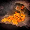 This undated electron microscope image made available by the U.S. National Institutes of Health in February 2020 shows the Novel Coronavirus SARS-CoV-2, orange, emerging from the surface of cells, gray, cultured in the lab. Also known as 2019-nCoV, the virus causes COVID-19. Organizers of the Collision conference say they are cancelling the in-person component this year amid global concerns around a novel form of coronavirus. THE CANADIAN PRESS/NIAID-RML via AP