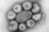 Influenza virus particles are seen under an electron microscope. (Dr. F. A. Murphy/Centers for Disease Control via The Associated Press)