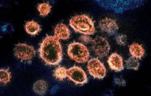 FILE - This 2020 electron microscope image provided by the National Institute of Allergy and Infectious Diseases - Rocky Mountain Laboratories shows SARS-CoV-2 virus particles which cause COVID-19, isolated from a patient in the U.S., emerging from the surface of cells cultured in a lab. According to a study released in The Lancet Global Health on Wednesday, Oct. 27, 2021, Fluvoxamine, a cheap antidepressant, reduced the need for hospitalization among high-risk adults with COVID-19. (NIAID-RML via AP)