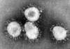 Manitoba health providers get coronavirus alert