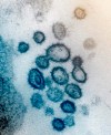 This undated electron microscope image made available by the U.S. National Institutes of Health in February 2020 shows the Novel Coronavirus SARS-CoV-2. Also known as 2019-nCoV, the virus causes COVID-19. The sample was isolated from a patient in the U.S. Dozens of research groups around the world are racing to create a vaccine as COVID-19 cases continue to grow. (NIAID-RML via AP)