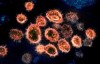 FILE - This 2020 electron microscope image provided by the National Institute of Allergy and Infectious Diseases - Rocky Mountain Laboratories shows SARS-CoV-2 virus particles which cause COVID-19, isolated from a patient in the U.S., emerging from the surface of cells cultured in a lab. According to two new studies released on Tuesday, Dec. 22, 2020, people who have antibodies from infection with the coronavirus seem less likely to get a second infection for several months and maybe longer. (NIAID-RML via AP)