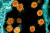 This electron microscope image made available and color-enhanced by the National Institute of Allergy and Infectious Diseases Integrated Research Facility in Fort Detrick, Md., shows Novel Coronavirus SARS-CoV-2 virus particles, orange, isolated from a patient. University of Hong Kong scientists claim to have the first evidence of someone being reinfected with the virus that causes COVID-19. They said Monday, Aug. 24, 2020 that genetic tests show a 33-year-old man returning to Hong Kong from a trip to Spain in mid-August had a different strain of the coronavirus than the one he’d previously been infected with in March. (NIAID/National Institutes of Health via AP)