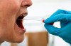 A medical worker performs a mouth swab on a patient to test for Covid-19 coronavirus, in tent extension of the Rigshospitalet Hospital, in Copenhagen, Denmark, Thursday, April 2, 2020. THE CANADIAN PRESS/AP-Niels Christian Vilmann/Ritzau Scanpix via AP