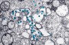 This 2020 electron microscope image made available by the U.S. Centers for Disease Control and Prevention shows the spherical particles of the new coronavirus, colorized blue, from the first U.S. case of COVID-19. Researchers in Canada say the best early-warning system for a second wave of COVID-19 may be right beneath our feet, in the sewers. THE CANADIAN PRESS/AP-Hannah A. Bullock, Azaibi Tamin/CDC via AP)