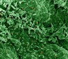 A colourized scanning electron micrograph of monkeypox virus (orange) on the surface of infected VERO E6 cells (green) is shown in a handout photo captured at the NIAID Integrated Research Facility (IRF) in Fort Detrick, Maryland. An expert is urging Canadian universities and colleges to be proactive about preventing monkeypox from gaining a foothold on campus. University of Manitoba virologist Jason Kindrachuk says schools should be raising awareness about the risks of monkeypox as students prepare to come together this fall. Kindrachuk notes that, so far, monkeypox cases in Canada have been concentrated among men who reported intimate sexual contact with other men, but the virus can spread to anyone through extended close contact. THE CANADIAN PRESS/HO-National Institute of Allergy and Infectious Diseases **MANDATORY CREDIT**