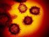 This transmission electron microscope image shows SARS-CoV-2, the virus that causes COVID-19. (NIAID/TNS)