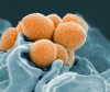 This handout image provided by the National Institute of Allergy and Infectious Diseases shows an electron microscope image of Group A Streptococcus (orange) during a phagocytic interaction with a human neutrophil (blue). THE CANADIAN PRESS/AP-National Institute of Allergy and Infectious Diseases via AP