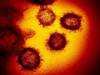 This transmission electron microscope image shows SARS-CoV-2, the virus which causes COVID-19. (NIAID/TNS)