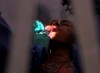 A dentist works on a patient on Monday, July 26, 2021, in San Juan, Texas.&nbsp;The federal housing and dental benefits rolled out last year have had 