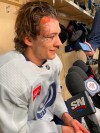 Winnipeg Jets center Morgan Barron speaks with reporters while sitting at his stall in the visitor's locker-room at T-Mobile Arena in Las Vegas on Thursday April 20, 2023. 
Barron said he will be able to play in Game 2 against the Vegas Golden Knights despite taking a skate in the face in Game 1. The gash required over 75 stitches to close. 
THE CANADIAN PRESS/Gregory Strong
