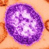 The Quebec government says thousands of people might have been exposed to measles at a shopping mall north of Montreal earlier this month, as an outbreak of the highly contagious disease continues to grow. This undated image made available by the Centers for Disease Control and Prevention on Feb. 4, 2015, shows an electron microscope image of a measles virus particle, centre. THE CANADIAN PRESS/AP-Cynthia Goldsmith/Centers for Disease Control and Prevention via AP