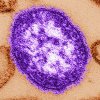 Ontario is seeing a massive surge in measles cases as an ongoing outbreak spreads in the province among unvaccinated people. This undated image made available by the Centers for Disease Control and Prevention on Feb. 4, 2015 shows an electron microscope image of a measles virus particle. THE CANADIAN PRESS/AP, HO — Centers for Disease Control and Prevention, Cynthia Goldsmith
