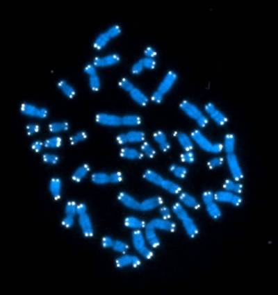 The Associated Press Files
                                This undated image shows the 46 human chromosomes, where DNA resides and performs its complex functions involved in regulating genetic activity.